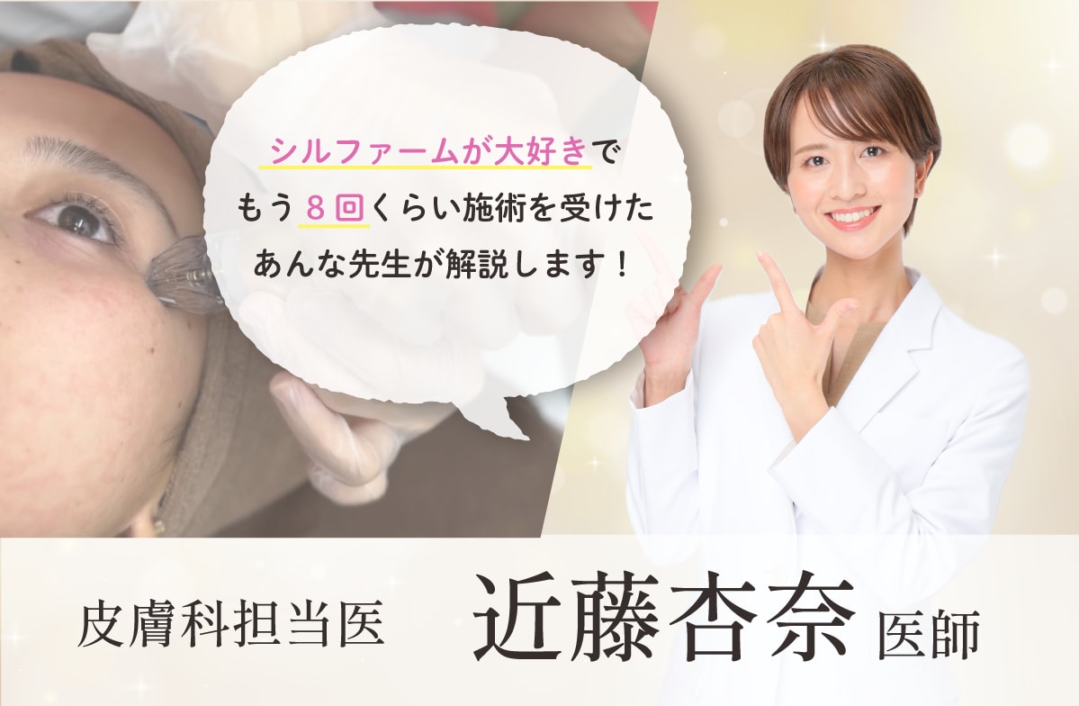 ポテンツァよりオススメなポイントは？